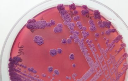 Melioidosis: Penyakit Tropis Terabaikan pada Manusia dan Satwa Primata